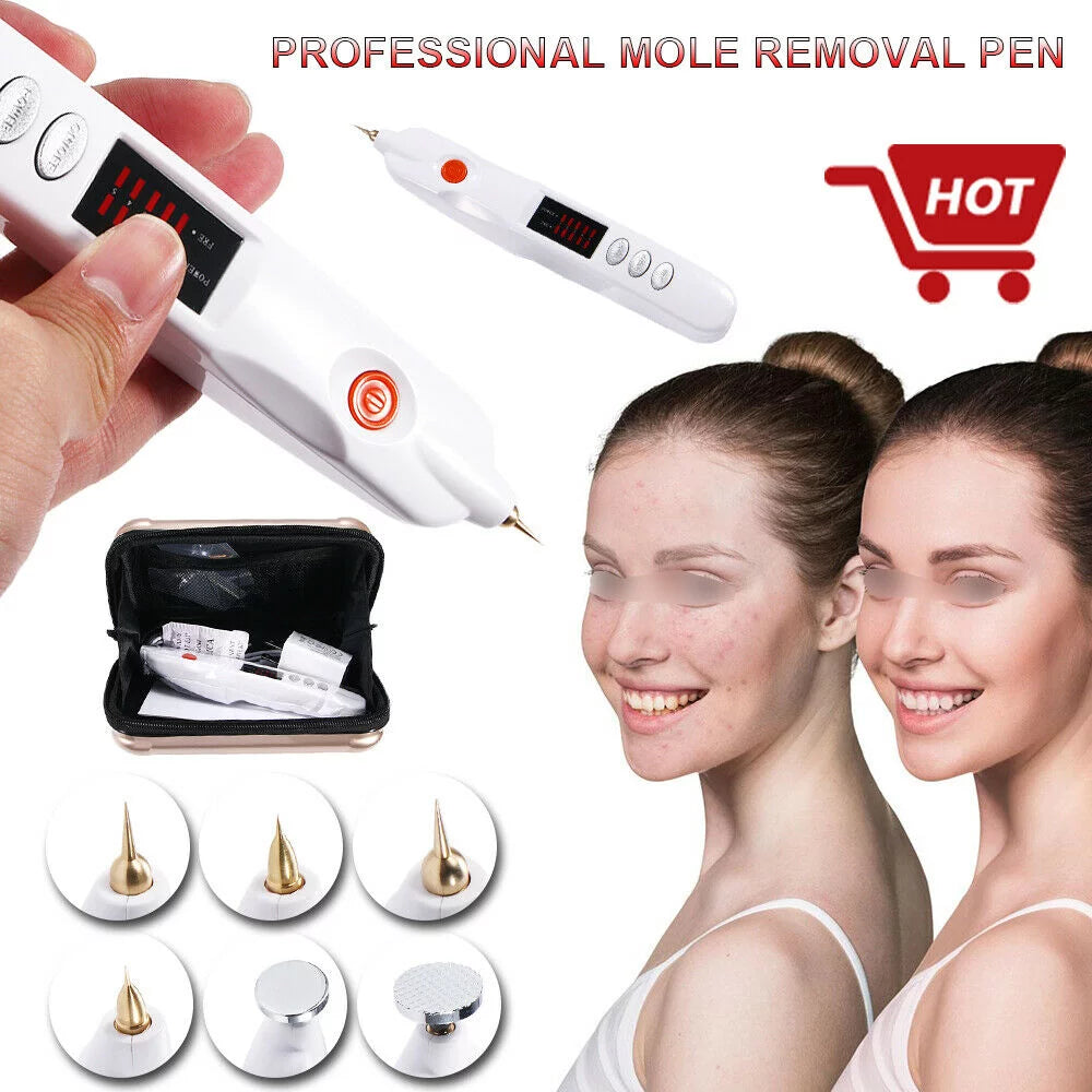 Plasma Laser Pen for Skin Spot and Wart Removal X3287